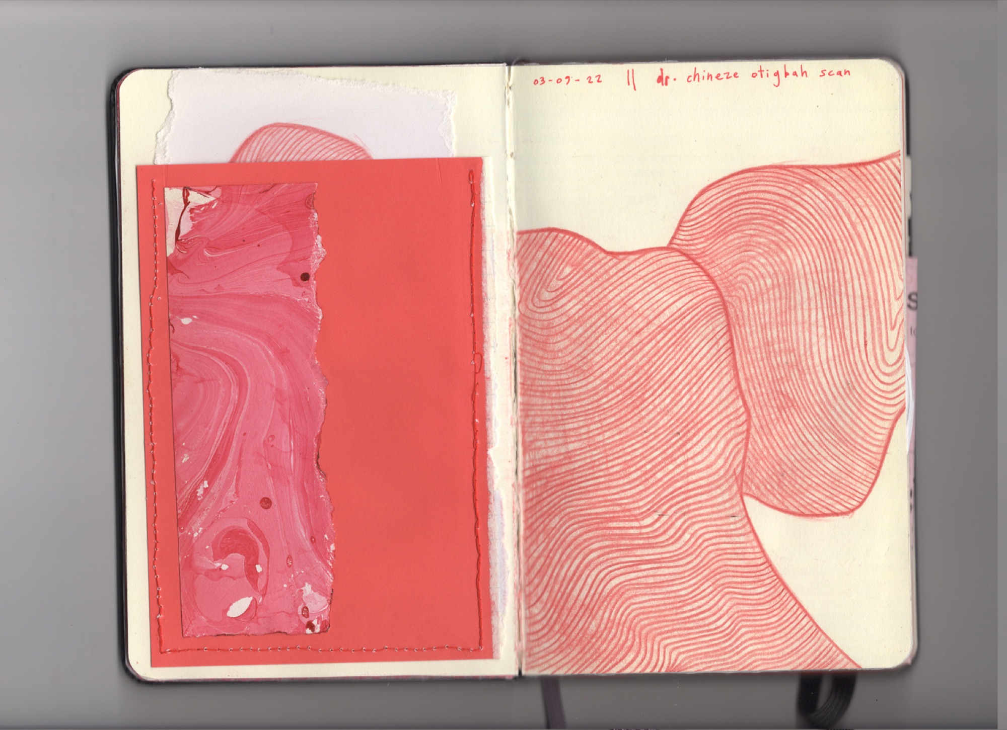 Anna Stiles — Endometriosis Illustrated