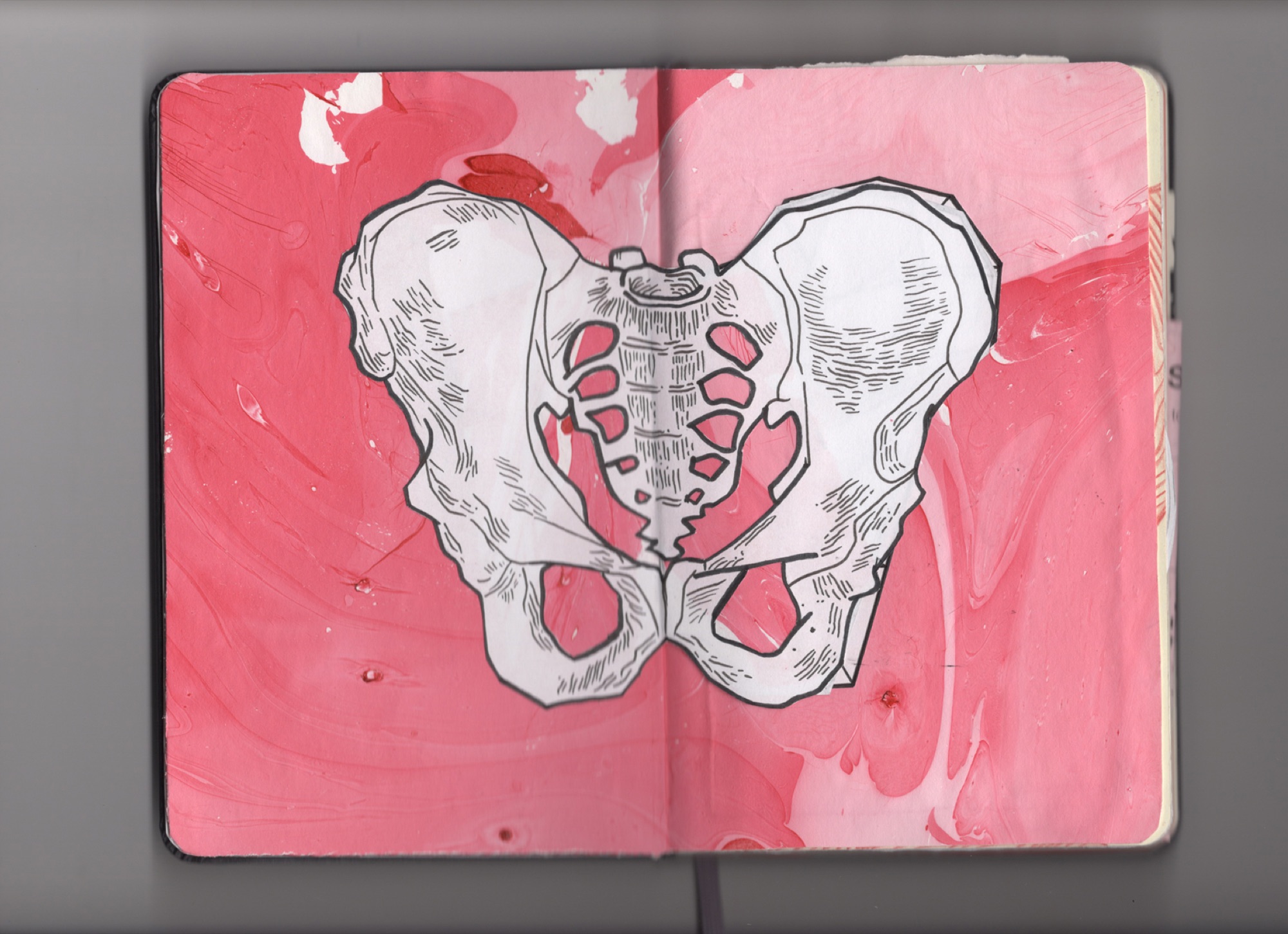 Anna Stiles — Endometriosis Illustrated